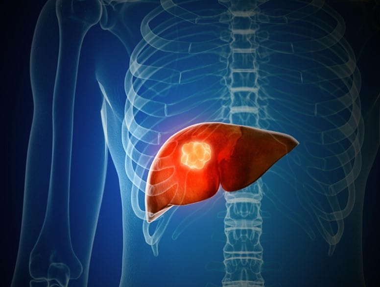 Detoxify your liver with these five simple foods