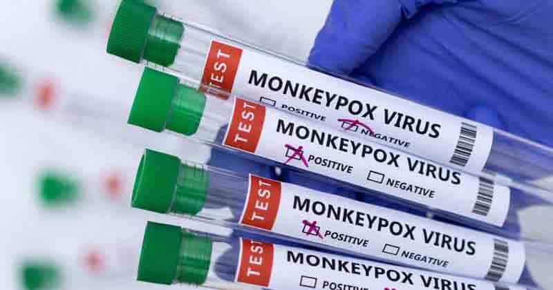 Monkey Pox - Updatenews360