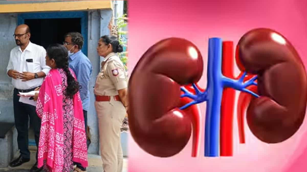 கிட்னி திருட்டு விவகாரம்… குற்றவாளிகளை தேடும் போலீஸ் : அமைச்சர் சொன்ன ஷாக் தகவல்!